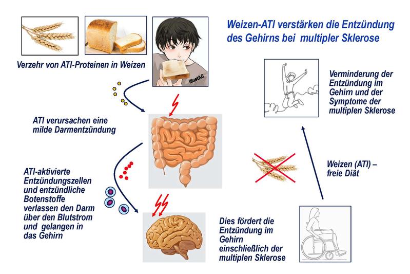 Forschende der Universitätsmedizin Mainz zeigen, dass eine weizenhaltige Ernährung die Er-krankungssymptome bei MS verstärken kann. Dabei verstärkten die ATI-Proteine, nicht aber die auch im Weizen enthaltenen Glutenproteine die Entzündung im Gehirn.