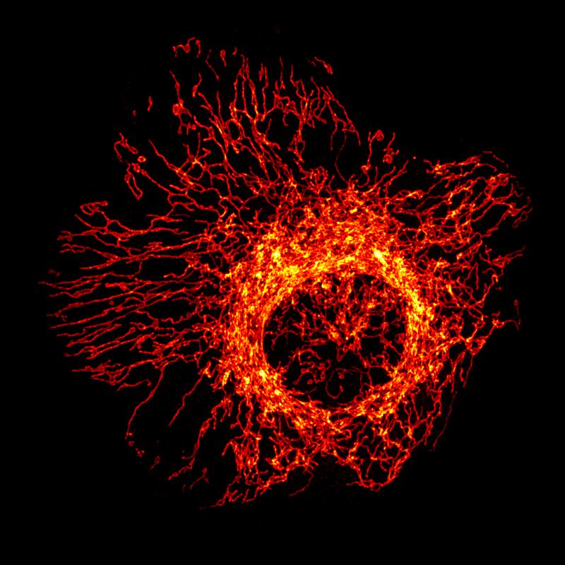 Mitochondrial network in a cell. 