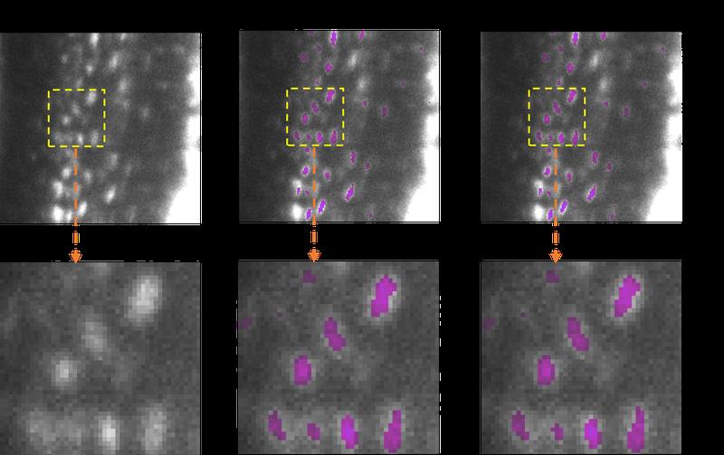 Semantische 3D-Segmentierung von Osteozyten in Mäuseknochen (Aufnahmen via Lichtblatt-Fluoreszenzmikroskop) 