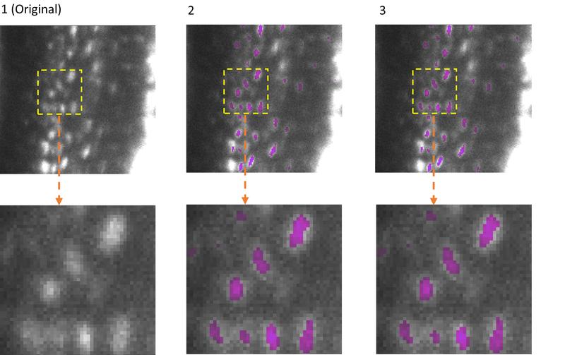 Semantic 3D segmentation of osteocytes in mouse bones (images via light sheet fluorescence microscope)