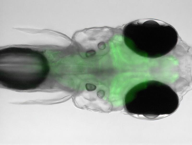Head of a zebrafish larva. The transparent nature of these animals allows their brain to be identified under the microscope. It is colored green in the image because it produces a dye that lights up green during neuron activity. 