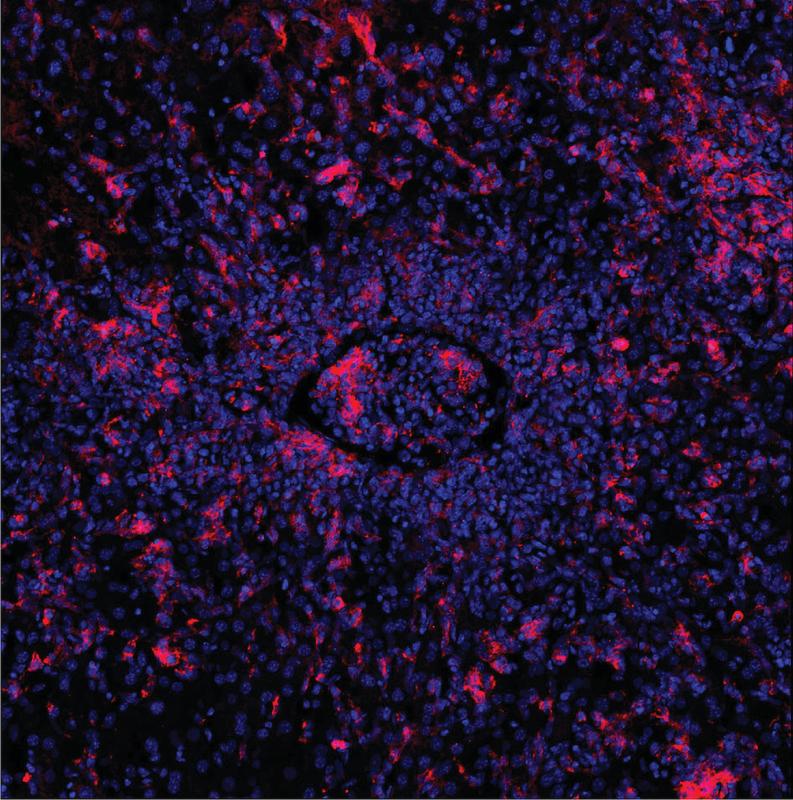 Lebergewebe von Mäusen, die als Modell für die seltene Immunerkrankung FHL dienen: Genetisch veränderte T-Zellen können die von EBV befallenen B-Zellen (rot) nicht abtöten. Andere Immunzellen strömen deshalb ein und blockieren ein Blutgefäß (Mitte).
