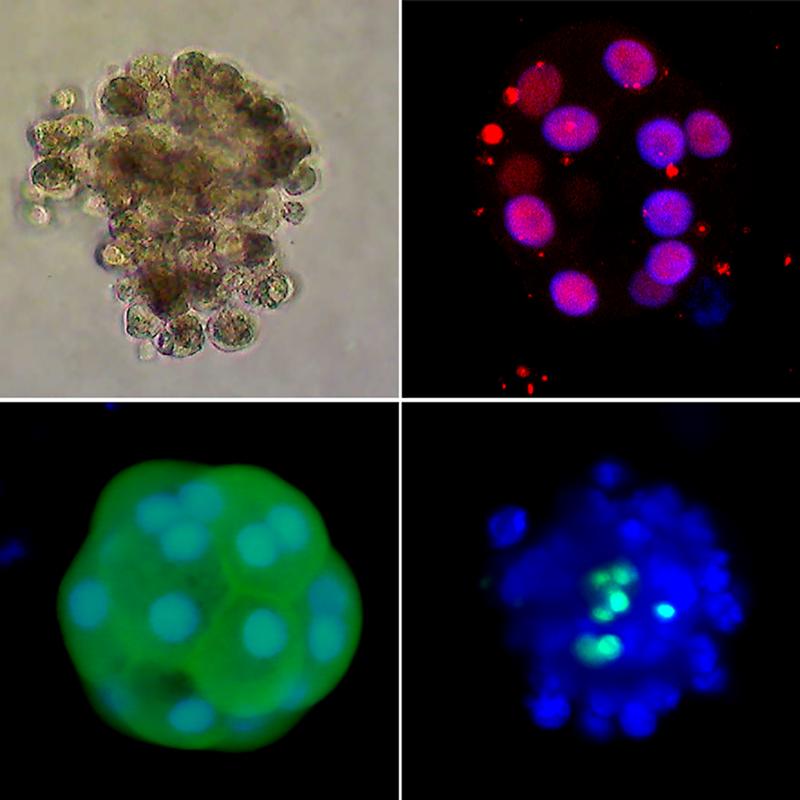 Mikroskopische Aufnahmen sogenannter humaner Organoide mit Leberzellen, die sich mit Hilfe des identifizierten Wachstumsfaktors MYDGF besser vermehren lassen.