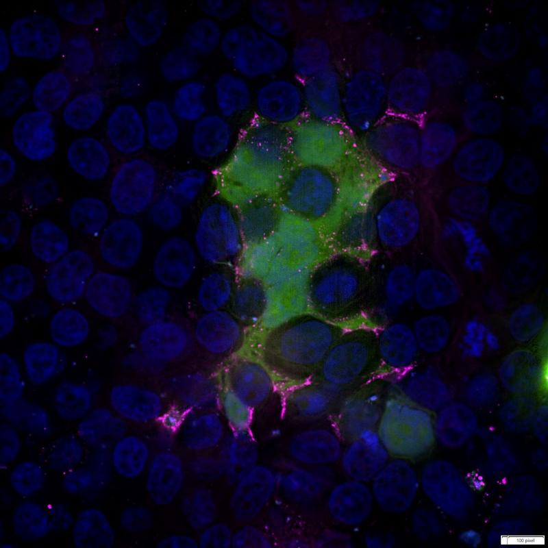 Microscopic image of cells infected with RSV. Green: RSV-F protein labelled with GFP in the cytoplasm of the cells, magenta: RSV-F protein, blue: cell nuclei.