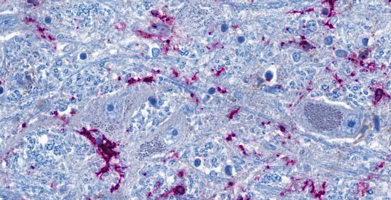 Ausschnitt aus dem Hirnstamm: Nervenzellen (graublau) stehen eng mit hirneigenen Immunzellen (lila) in Kontakt. Die blauen fadenförmigen Strukturen sind Fortsätze der Nervenzellen, die als Nervenfasern bis in weit entfernte Organe hineinreichen können.