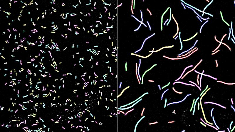 Unter dem Mikroskop zeigt sich das Bakterium Klebsiella pneumoniae typischerweise in Form kurzer Stäbchen (l.). Ist die DNA der Bakterien jedoch beschädigt, wachsen die Zellen im Verlauf der Stressantwort weiter und es entstehen lange Bakterien (r.).