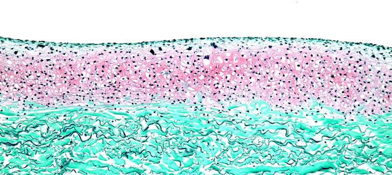 Histological staining (Safranin-O/Fast Green) of the finished cartilage construct N-TEC. The cartilage cells from the nasal septum were applied to a collagen membrane (green) and formed a distinct cartilage layer (red), in black the cell nuclei.