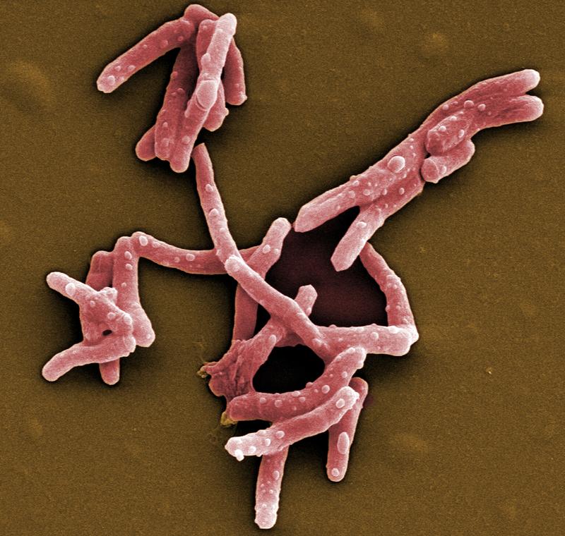 Elektronenmikroskopische Aufnahme des Tuberkulose-Erregers Mycobacterium tuberculosis