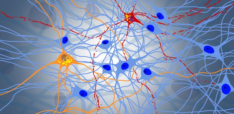 Digital drawing of progressive degeneration in a neuronal network: blue represents healthy neurons, while orange and red represent the protein NPTX2. Yellow shows the toxic aggregation of the protein TDP-43.