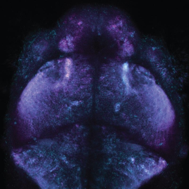 Inside a fish brain: the novel chemical labeling method makes use of distinguishable fluorescent dyes, here magenta and blue, to record cellular activities for later analysis.