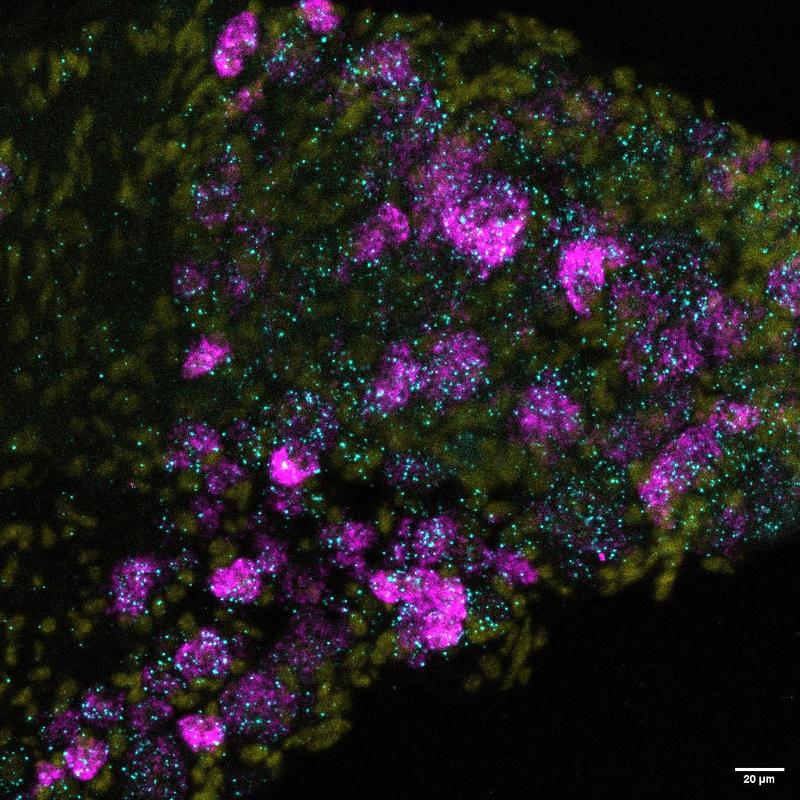•	Nervenzellen in der Maus: Der neue Ionenkanal Elkin1 (cyan), der für die Wahrnehmung von Berührungen wichtig ist, Zellkerne (gelb) und der bereits bekannte Ionenkanal Piezo2 (magenta).