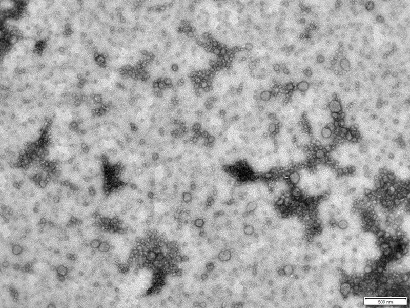 Extracellular vesicles of the haloarchaeon Haloferax volcanii, made visible with an electron microscope. The scale bar measures 500 nm. 