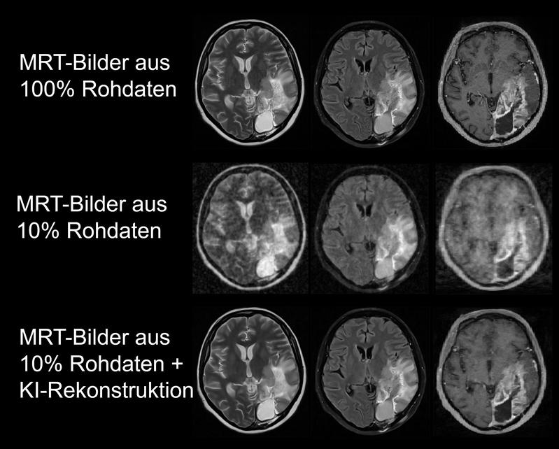 Die vollständige Bildunterschrift befindet sich unter dem Text. Die Bilder in der ersten Reihe wurden aus vollständigen Rohdaten erstellt, die Bilder in der zweiten Reihe aus zehn Prozent der Daten und in der dritten Reihe mithilfe des KI-Algorithmus.