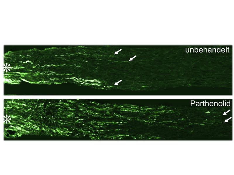 Longitudinal sections of damaged sciatic nerves. Asterisks mark the injury sites - regenerating axons are green. Compared to untreated controls (top), daily treatment with parthenolide (bottom) improves nerve fiber regrowth.