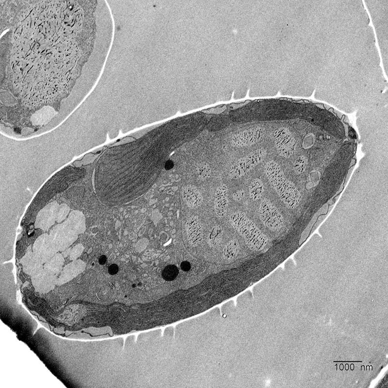 Cross-section of a cell of the microalga Prorocentrum cordatum. The nucleus with the chromosomes is on the right. A single barrel-like chloroplast takes up 40 percent of the cell volume.