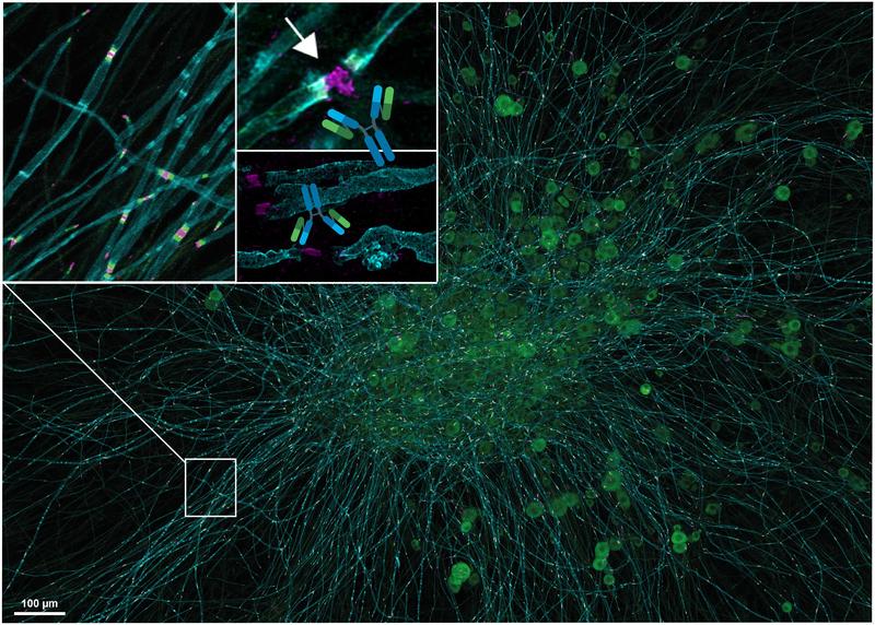 Übersicht einer Spinalganglien-Kultur mit Nervenzellen (grün) und ihren Fortsätzen, den myelinisierten Axonen (cyan). In der Vergrößerung sieht man die Ranvier-Schnürringe mit Neurofascin-Protein (magenta), links reguläre Schnürringe, rechts zerstörte. 