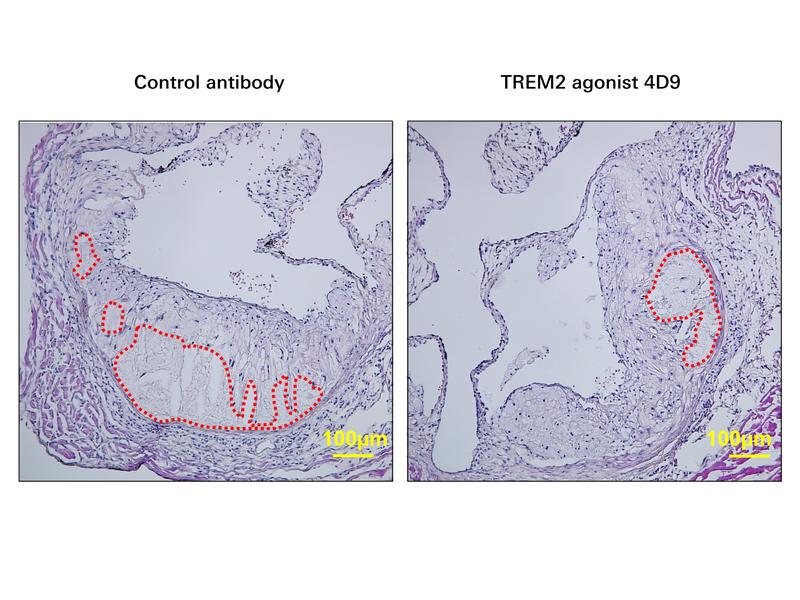 Treatment with the agonistic TREM2 antibody 4D9 leads to the formation of smaller necrotic cores (red outlines) in atherosclerotic plaques of the aortic root in Ldlr-/- mice. 