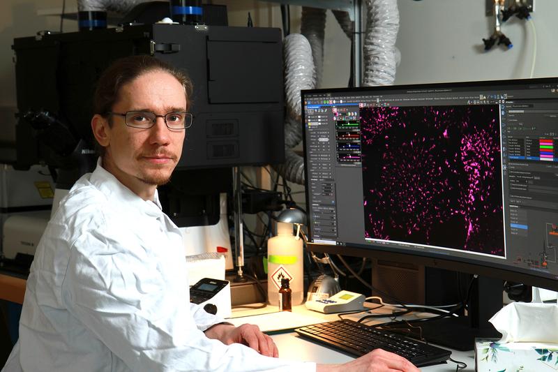 Dr. Fabian Lukas forscht zu Adhäsionsstrukturen in Zellen. Zu sehen ist hier eine Mikroskopaufnahme von menschlichen Pigmentepithelzellen, bei denen das Integrin fluoreszierend markiert ist. 