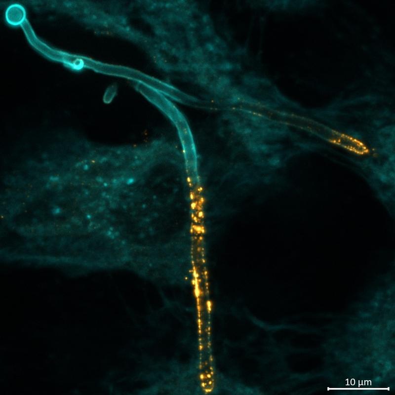 The fungus Candida albicans (blue colouring) invades a human epithelial cell and produces the toxin Candidalysin (golden colouring).