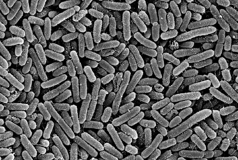 Pseudomonas aeruginosa mit dem Elekronenmikroskop aufgenommen. 