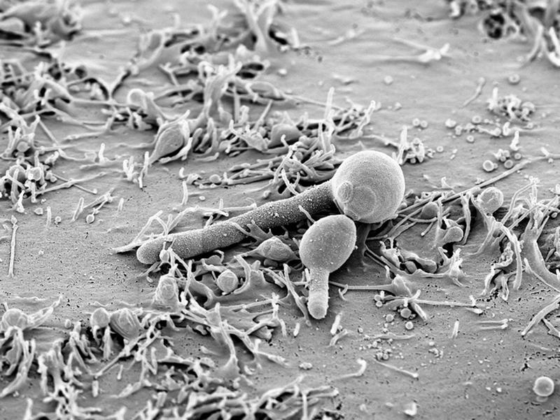 Candida albicans in the yeast and hyphae form on human epithelial cells.