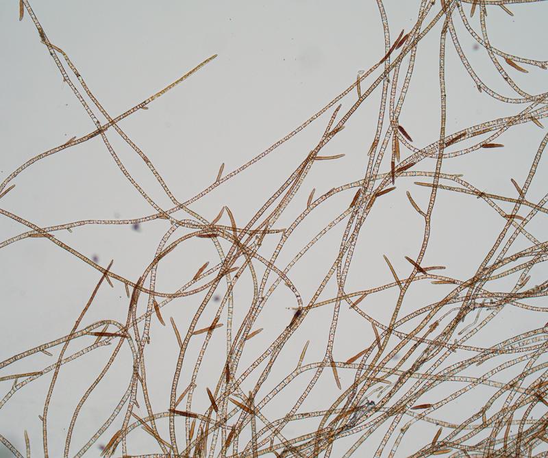 Microscopic view of Ectocarpus sp. mature gametophyte filaments. Gametes are produced in plurilocular gametangia, structures that become thicker and dark-brown when mature. 