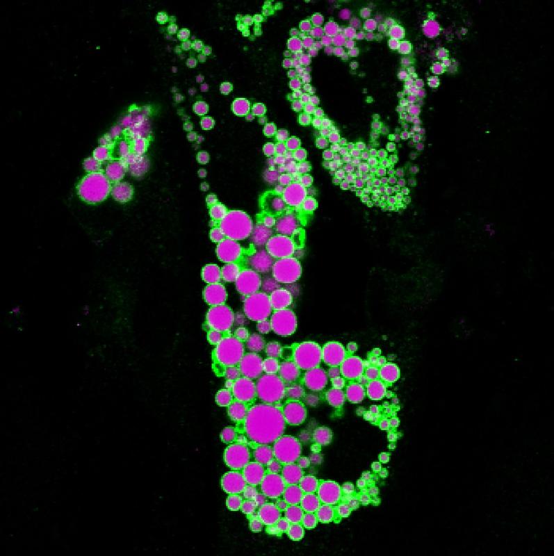 Human adipocyte with lipid droplet labeled in magenta and regulatory protein in green. 