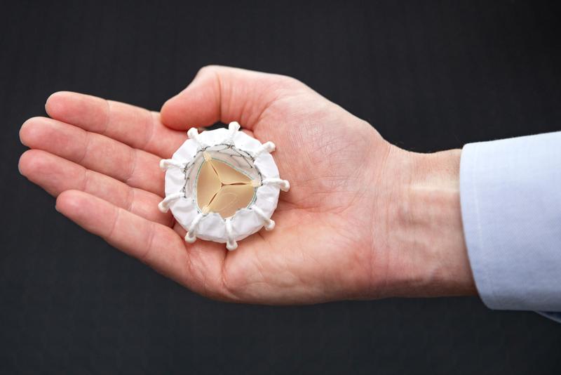 The new prosthesis for the tricuspid valve: it is inserted into the heart using a catheter and positioned there.