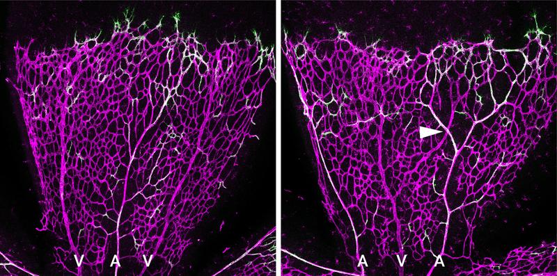 Die Deletion von EphB4 verstärkt die Arterienbildung durch Tip-Zellen