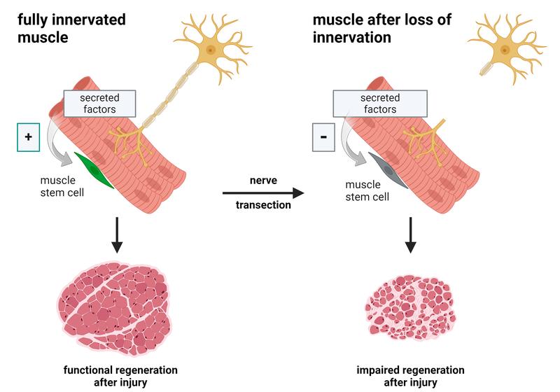 The graphic documents how nerve connections influence the healing process 