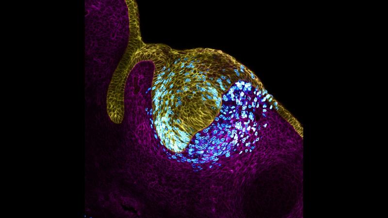 Zahnepithel (gelb) u.Mesenchym (magenta).Proliferierende Zellen (cyan) dehnen das Gewebe aus u.erzeugen einen mechanischen Druck in der Mitte des Gewebes. Dieser treibt die Bildung des zentralen Signalzentrum des Zahnes voran,dem Organisator,Schmelzknospe