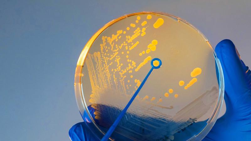 View of a petri dish with cholera bacteria (Vibrio cholerae).