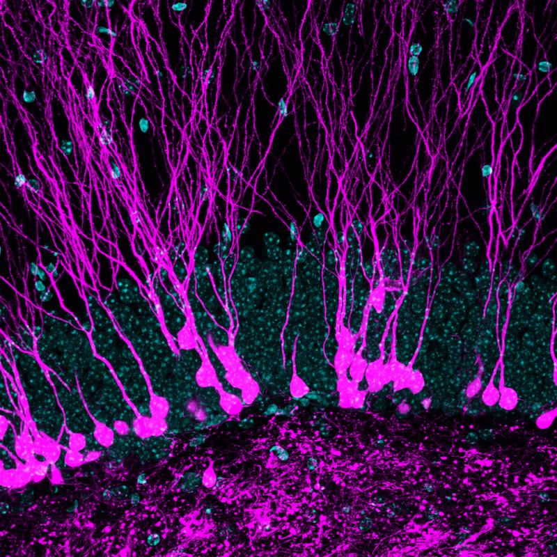 Das Bild zeigt neue Neuronen (magenta) im Hippocampus einer erwachsenen Maus. Zellkerne sind cyan gefärbt. Die langen Dendriten sind der wichtige Orte, an denen Mechanismen der Plastizität und des Wettbewerbs um das Zellüberleben stattfinden.