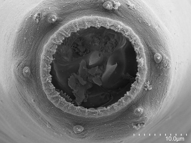 Bei A. sudhausi wurde eine neue Mundform identifiziert, die als Teratostomatous (Te) bezeichnet wird. Würmer mit Te-Mäulern werden sowohl auf dem Pilz Penicillium camembert als auch unter Hungerbedingungen gebildet und kannibalisieren ihre Verwandten. 