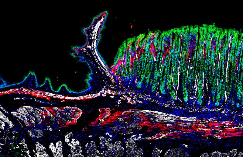 Tissue section from the gastroesophageal junction of a mouse, illustrating the spatial distribution of various cell types through immunostaining. Green: epithelial cells, red and white distinct fibroblast subpopulations, with nuclei stained blue.