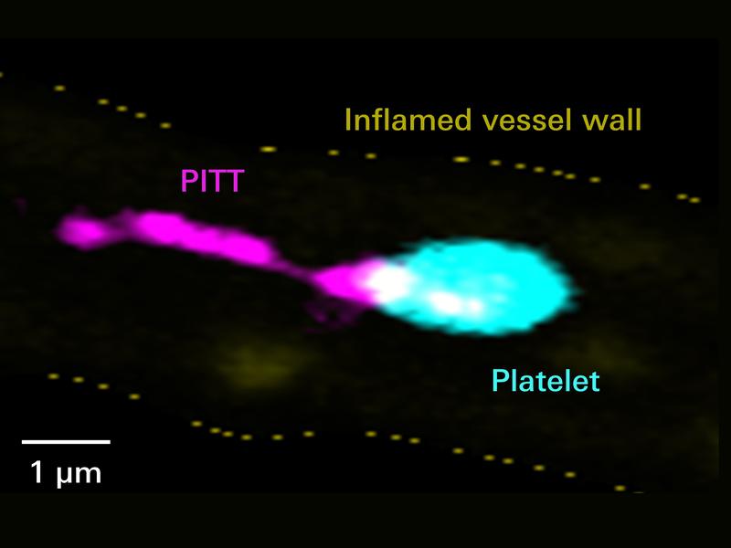 The PITTs - Platelet-derived Integrin- and Tetraspanin-enriched Tethers - observed here in the mouse by Bernhard Nieswandt are comet-tail-like organelles shed by platelets that interact with other cells in the vascular system and modulate their function.