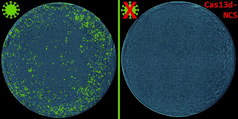 Treatment with Cas13d-NCS prevents the spread of SARS-CoV-2 (green)