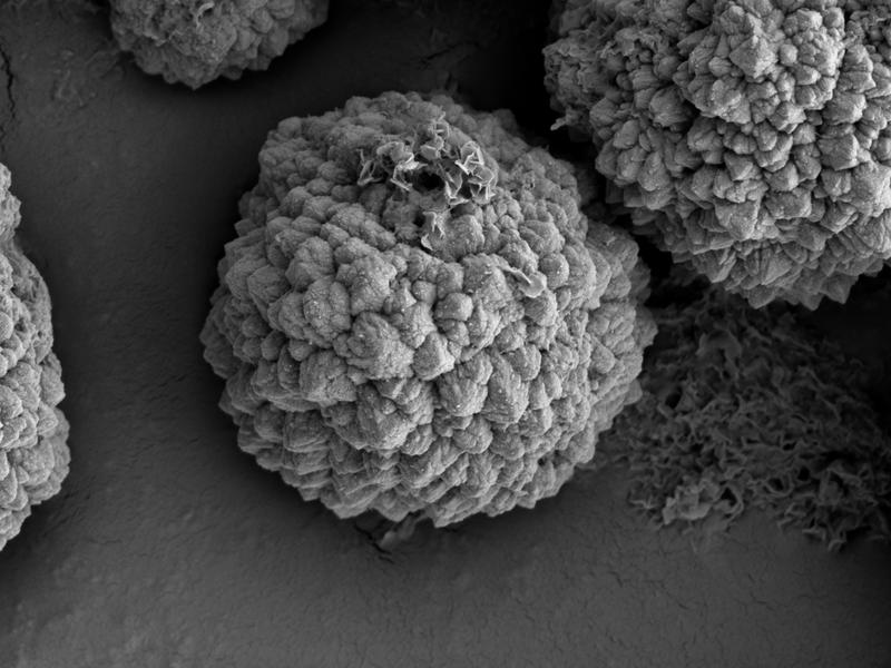 Elektronenmikroskopische Aufnahme der kugelförmigen Pyritkristalle aus Experimenten mit biologischem Magnetit. Der Durchmesser der Strukturen ist etwa fünf Mikrometer (Tausendstel Millimeter). 