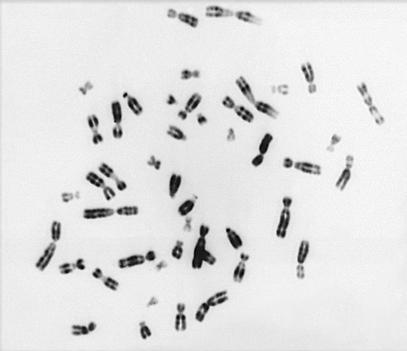 Anfärbung der DNA einer gesunden menschlichen Zelle mit insgesamt 26 Chromosomen. Überzählige Chromosomen verursachen normalerweise ein schädliches genetisches Ungleichgewicht