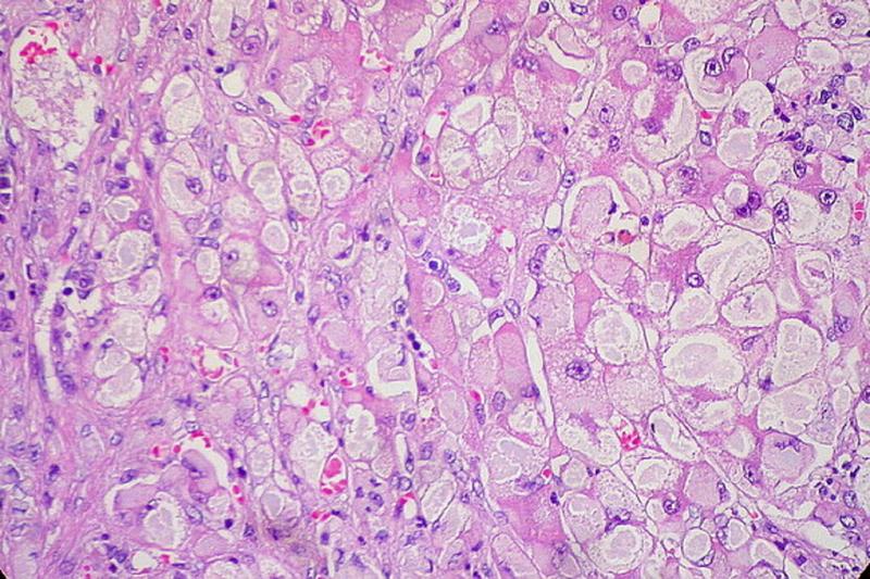 Hepatocytes Liver