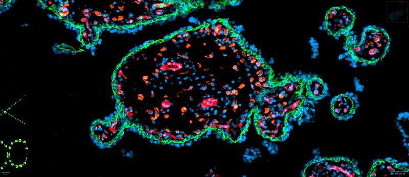 Plazentazotte: Umrandet ist sie von grünen Trophoblasten –  das sind die äußeren Zellschichten der Keimblase, die am vierten Tag nach der Befruchtung aus der mehrfach geteilten Eizelle entsteht. Die fetalen Gefäße sind rot, die Hofbauerzellen orange.