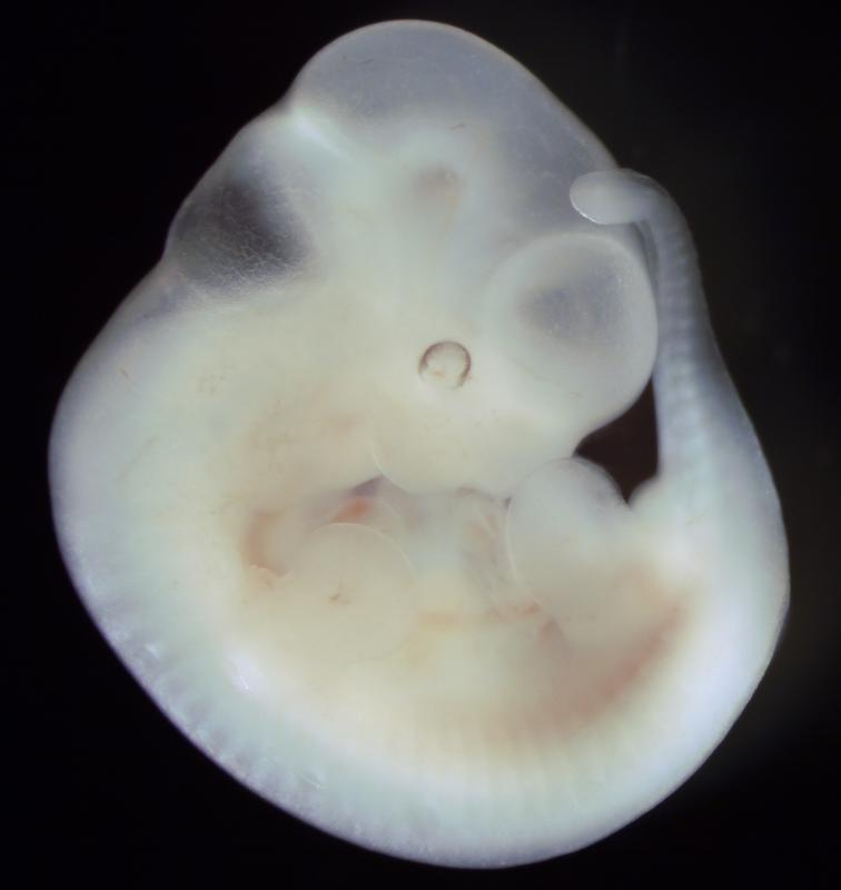 A mouse embryo. Through local interaction of individual cells, embryos create patterns of different cell types and organs. 