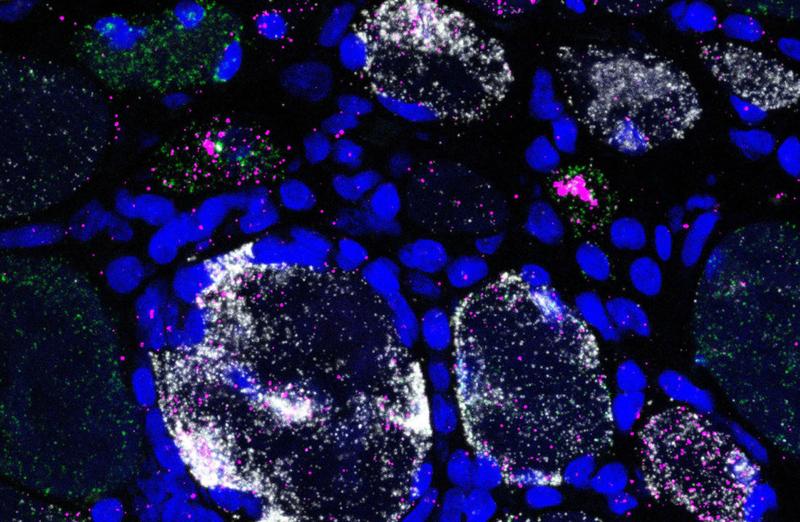 Die Fluoreszenzaufnahme zeigt den DNA-Schädigungsmarker GADD45A (magenta) in verschiedenen Muskelfasertypen (Typ-1-Muskelfaser = grün, Typ-2A-Muskelfaser = weiß). Zellkerne sind blau dargestellt.