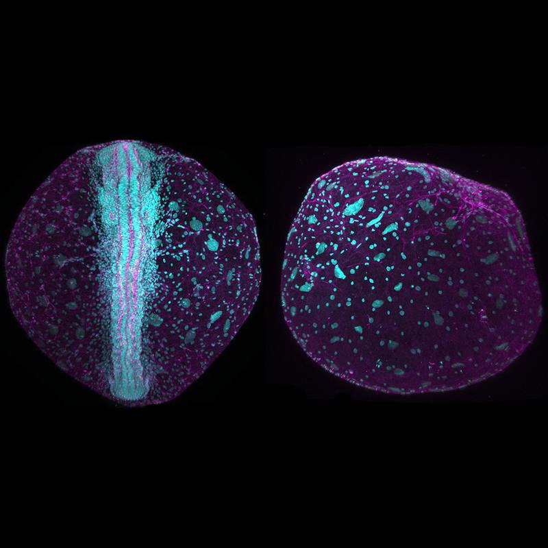 Killifisch-Embryos im Fluoreszenzmikroskop. Links mit ausgebildeter Achse, rechts ohne ausgeprägte Achse. Die Zellen bleiben verstreut.