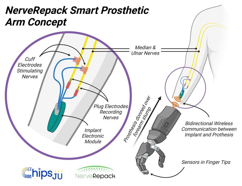 The NerveRepack prosthesis will be able to communicate wirelessly with an implant which transmits signals to and receives signals from nerves in the arm. This bidirectional communication will enable more intuitive use and increased patient autonomy. 