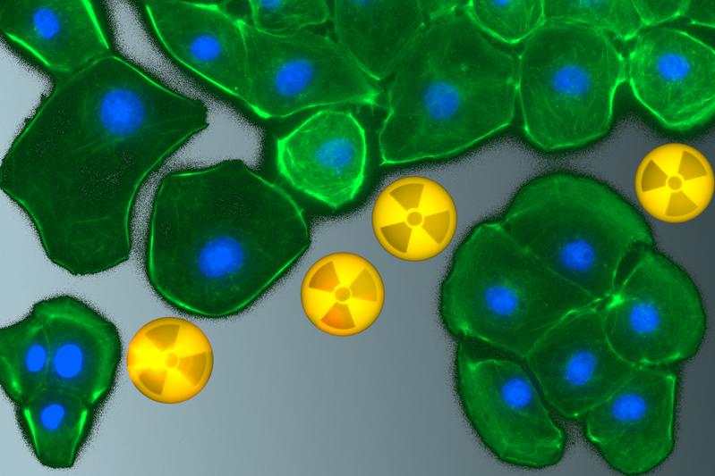 Fluorescence micrograph of rat kidney cells after treatment with radioactive heavy metal ions, the latter shown here symbolically.