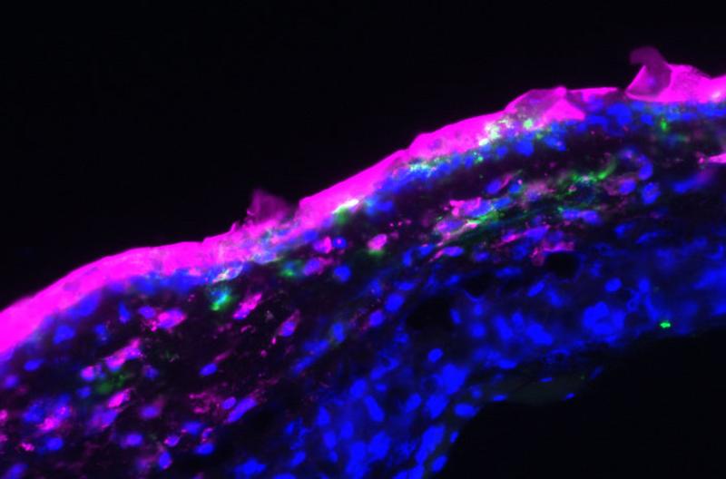 Fluorescence microscopy: The aptamers (here marked in pink) were applied to the top layer of the skin in the form of an ointment and also penetrate into the deeper layers (nucleus: blue; antigen-presenting cells: green). 