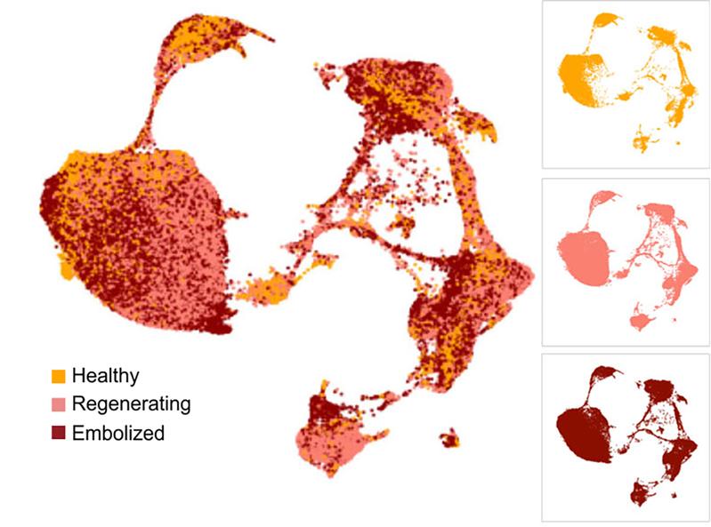 Map of liver cells of healthy regenerating and embolized liver samples, coloured by condition. Modified according to Fig. 2c from the original publication.