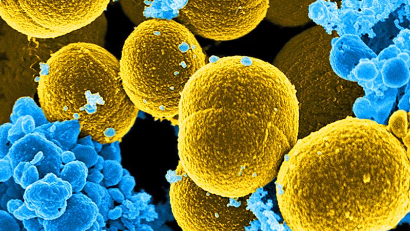 Digitally coloured scanning electron micrograph of multiple mustard-coloured, spherical Staphylococcus aureus bacteria attacked by blue-coloured human white blood cells.