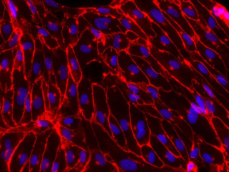 Immunfluoreszenzaufnahme: In der Kulturschale aus ETV2 iso2 hiPSCs differenzierte Endothelzellen in rot. Die Zellkerne sind blau.